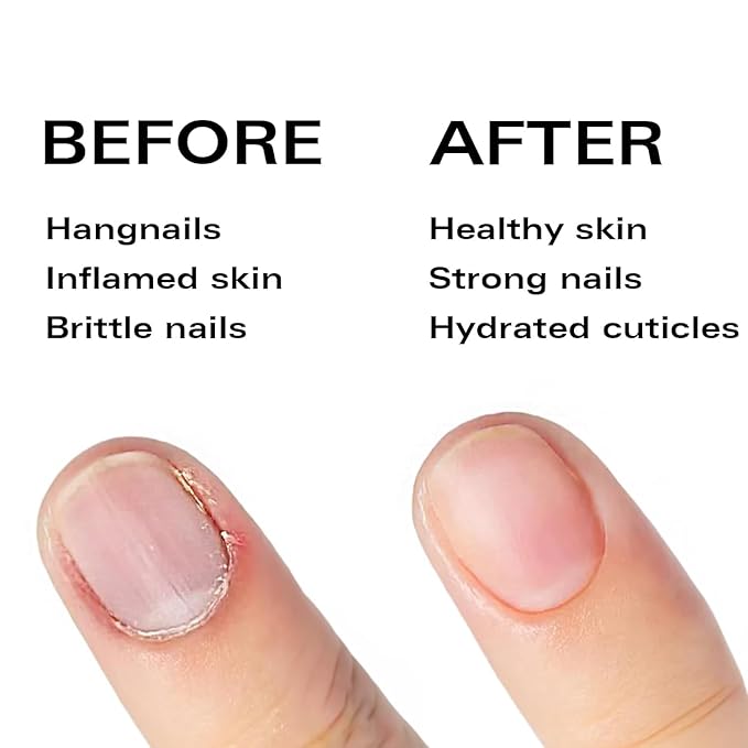 Beauty Power Nail Oil Cuticle Pen - Jasmine - Nail Strengthener & Growth Serum with Vitamin A, D, E, B5, Grapeseed & Natural Oils - Repair for Brittle, Peeling, Thin Nails - Twist Brush Pen