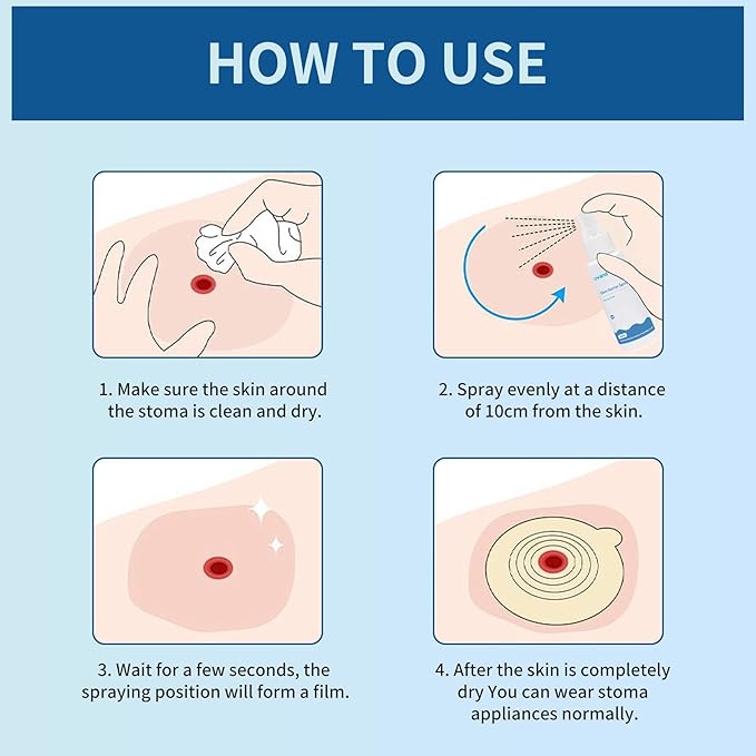 No Sting Ostomy Barrier Spray - Skin Barrier Film for Sensitive Skin - Skin Barrier for Protection Around Stomas and Wounds