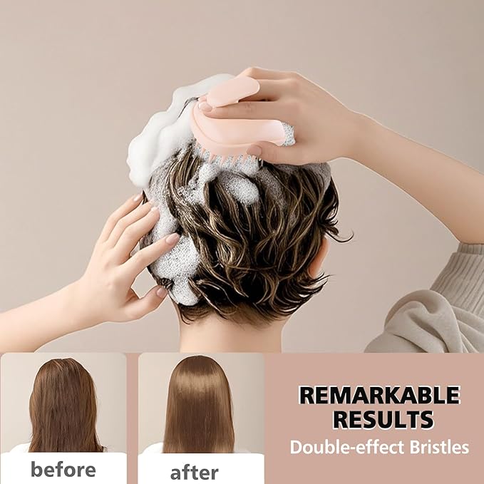 Rebex 2-in-1 Scalp Massager Shampoo Brush,Scalp Scrubber, Exfoliator Brush for Removing Dandruff & Hair Growth,Detangling Scrubber for Wet or Dry Hair (Peach Fuzz Color)