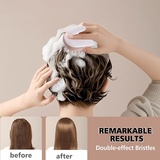 Rebex Scalp Massager Shampoo Brush,Scalp Scrubber,Exfoliator for Removing Dandruff & Hair Growth,Detangling Scrubber for All Hair(WhiteBrown)