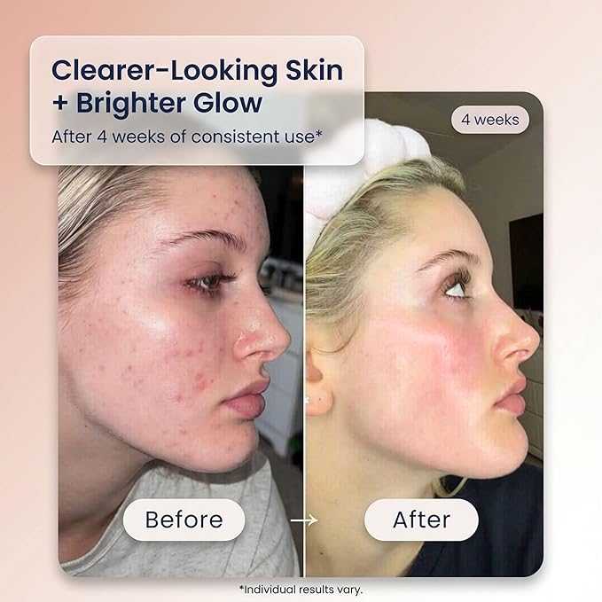Kay's Glow Vitamin C Serum for Face with Illuminating Oxygen & THD, Brightening AHA Dark Spot Remover & Anti-Aging Serum, Hydrating Primer for Smooth Makeup, 1 fl oz