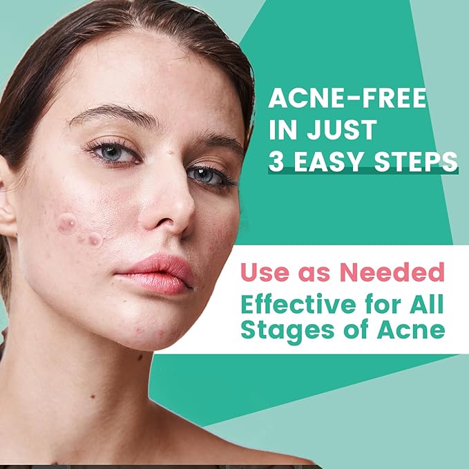 TEAWOO 3-Step Microdart Pimple Patches Set – 83 Count, including 9 Microdarts Pimple Patches, 50 Pimple Poppers, and 24 Hydrocolloid Patches