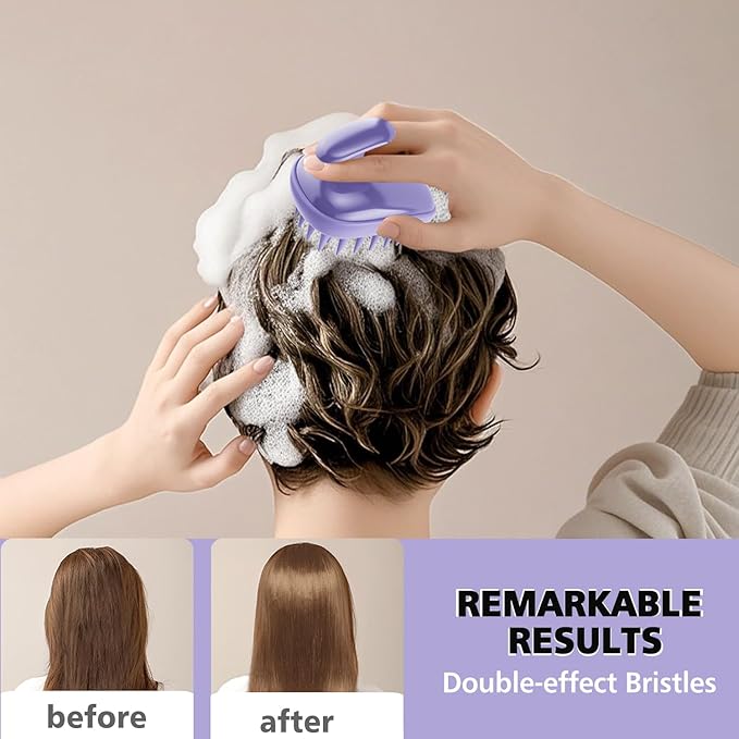 Rebex 2-in-1 Scalp Massager Shampoo Brush,Scalp Scrubber, Exfoliator Brush for Removing Dandruff & Hair Growth,Detangling Scrubber for Wet or Dry Hair - for All Hair Types(Purple)