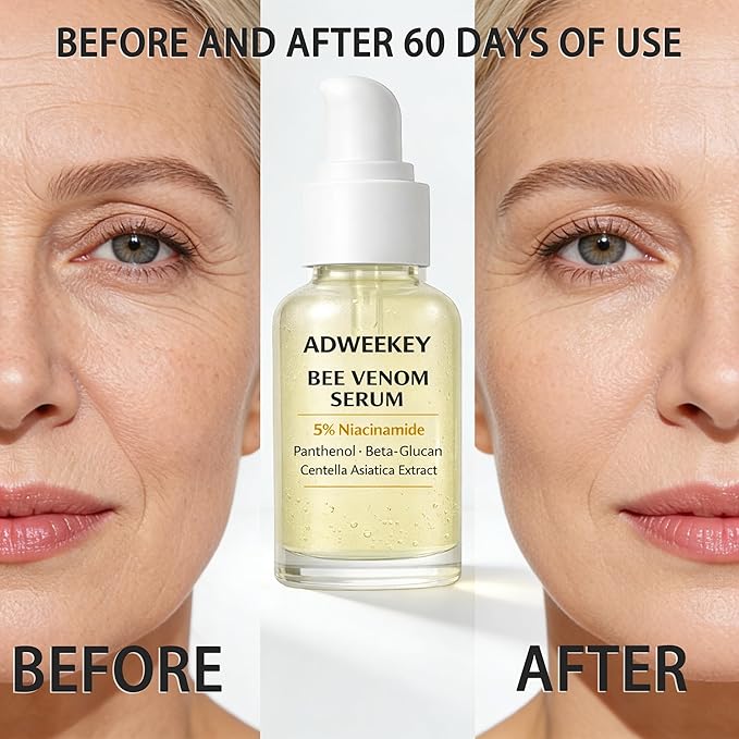 Bee Venom Serum for Face with 5% Niacinamide, Panthenol & Centella – Firming Hydrating Fragrance-Free Serum for Fine Lines, Sensitive Skin, 30 mL / 1.0 fl oz