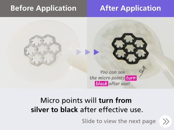 DWEasyDerm EasyDerm Magnesium Pimple Patches – Hydrocolloid Acne Spot Treatment with Ampoule & Tweezer, 10 Calming Zit Stickers by Daewoong, 이지덤, 대웅제약