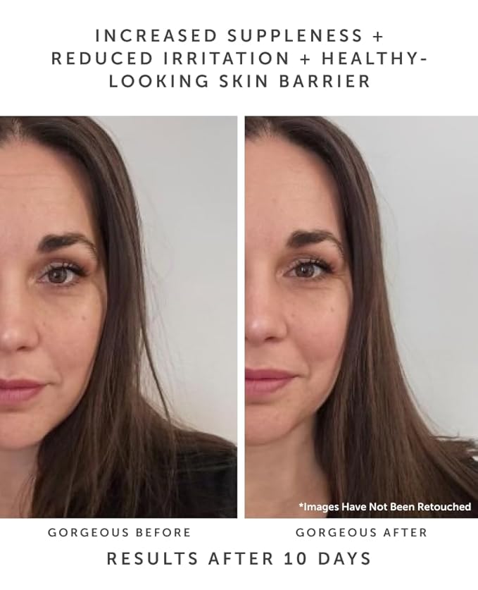 Earth Harbor | HORIZON Ceramide Recovery Serum - Skin Barrier + Hydration | Phytosterols + Blue Lotus + Beta Glucan | 20 ml