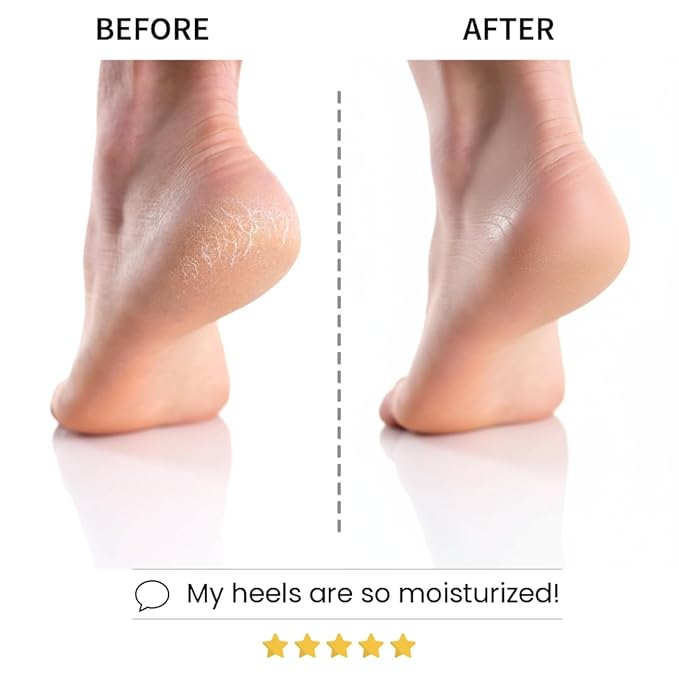 Codi New York Relaxing Aroma Foot Mask 6 Pairs | Soothes & Restores Tired, Dry Feet | Hydrating Foot Treatment for Cracked Heels & Rough Skin | Home Spa Pedicure Socks | Made In Korea (Lavender)