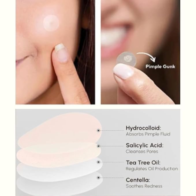 Pimple Patches – Hydrocolloid Acne Patches for Zits, Whiteheads & Blemishes, Fast Healing Zit Stickers, Invisible Pimple Spot Treatment for Face, Day or Night Use- 72 Count