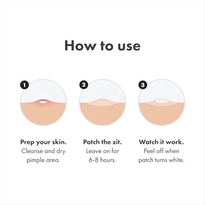Hydrocolloid Pimple Patches for Face – 144 Count Invisible Acne Spot Dots | Fast-Acting, Waterproof Zit Stickers | Non-Irritating Blemish Patches for Overnight Healing