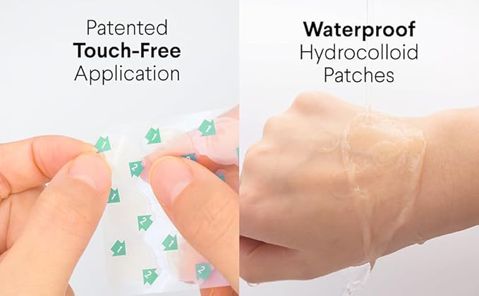 EZ Touch Acne Pimple Patch(75 Patches) New Normal Easy & Clean Innovative Patch, Natural Calm 12mm 60ea