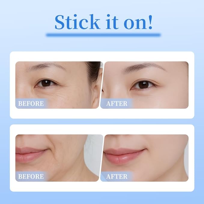 Natener 8 pairs PDRN Micro Eye Patches, Under Eye Patches for Puffy eyes, Dark Circles & Wrinkle | Hyaluronic Acid, Kojic Acid, Collagen, Peptides, Vitamin C, Niacinamide - Korean Popular Eye Care