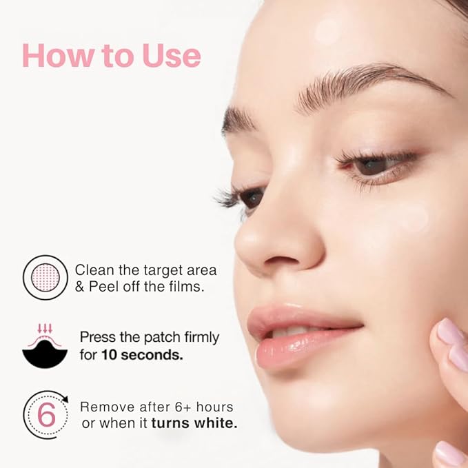 Pimple Patches – Hydrocolloid Acne Patches for Zits, Whiteheads & Blemishes, Fast Healing Zit Stickers, Invisible Pimple Spot Treatment for Face, Day or Night Use- 72 Count