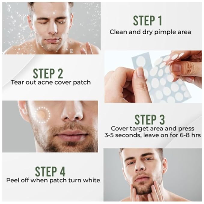 Pimple Patches- Hydrocolloid Acne Patches for Zits, & Blemishes- Clear Zit Stickers, Skin-Clearing Spot Treatment for Face- Fast Acting Acne Treatment for Day or Night- 108 Ct.