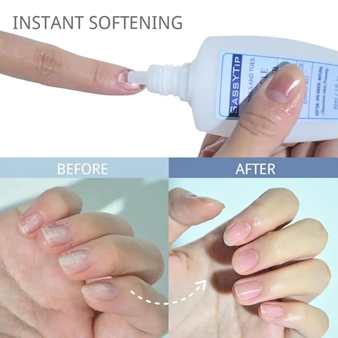 SASSYTIP Cuticle & Nail Duo: 15-Second Softening Gel + Strengthening Oil Pen with Jojoba & Vitamin E for Healthy, Manicured Nails (Lemon+Gel)