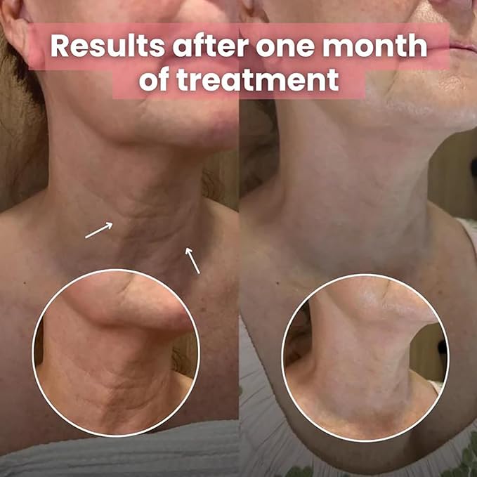 NiraBloom Korean Bio-Collagen Necklift Mask - Younger Neck After 1 Use, Bio Collagen Neck Patches, Hydrating, Plumping, Firming, Silicone Wrinkle Mask Reusable for Tightening and Firming (2)