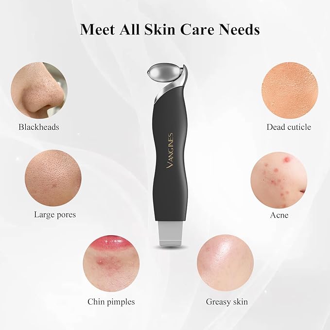 Vangines Blackhead Scraper Tool & Skin Scrubber Face Spatula for Blackhead Removal, Pore Cleaning, with Cooling Ice Roller & 2 Silicone Brush Heads (Charcoal Black)