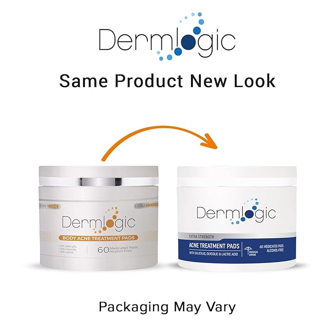 Acne Treatment Pads- Contains Salicylic, Glycolic, & Lactic Acid for Face & Body. Clears Away Clogged Pores, Oily Skin & Cystic Breakouts. Removes Dark Spots, Blackhead & Whitehead Pimples
