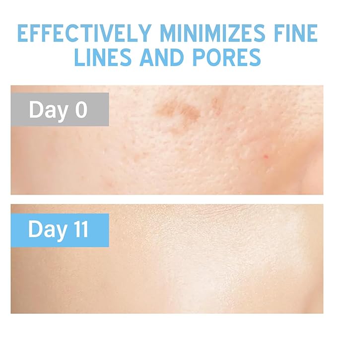Stem Cell Serum for Face, Anti Aging Face Serum to Smooth Wrinkles, Intensive Repair Ampoule for Hydration and Revitalization