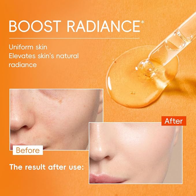 Vitamin C Serum for Face 2-Pack, Brightening Facial Serum with Hyaluronic Acid & Vitamin E, Helps Improve Dark Spots, Uneven Tone, Fine Lines & Wrinkles, 1 Fl Oz Each