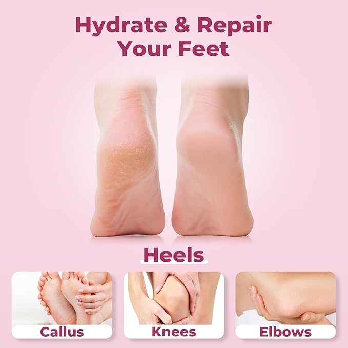 SAISZE Urea Cream 40 Percent for Feet Maximum Strength, Foot Cream for Dry Cracked Heels and Feet, Moisturizer with 40% Urea and 2% Salicylic Acid, 5.29 oz