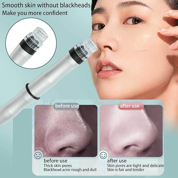 Hydrogen-Oxygen Facial Machine, Hydra Face Care Device for Skin Moisturizing – A Professional Vacuum Cleaning Jet Blackheads Remover for Home and Beauty Salon