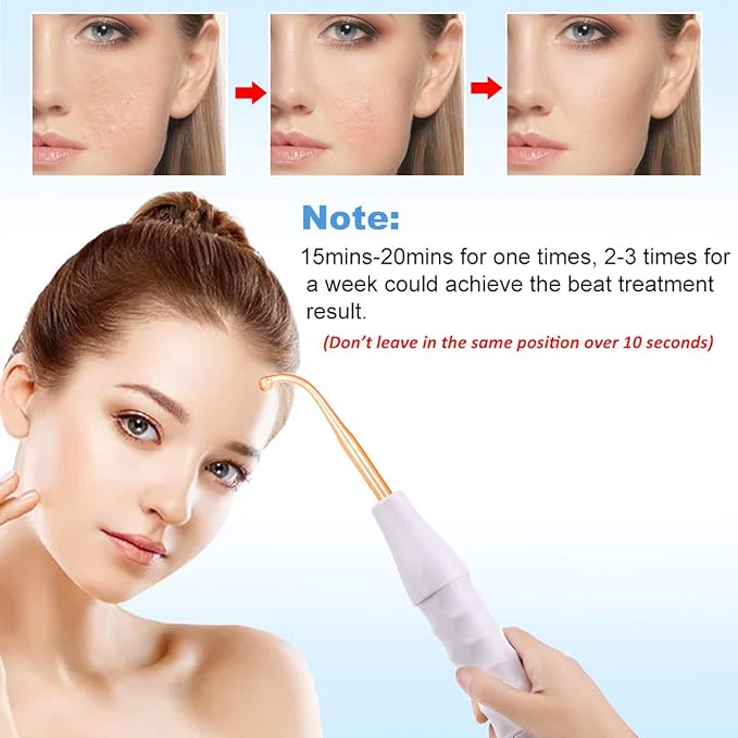 MYSWEETY High F Rrequncy Portable Handheld Facial Skin Care Wand Machine