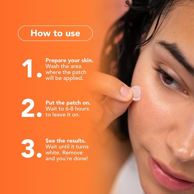 ALUX Skin Pimple Patches for Face, 30 Unit, Hydrocolloid Skin Care Acne Patches, Safe for Sensitive Skin, Use Under Makeup, Absorbing Spot Cover Stickers for Zits, Blemishes, Pimples, Breakouts