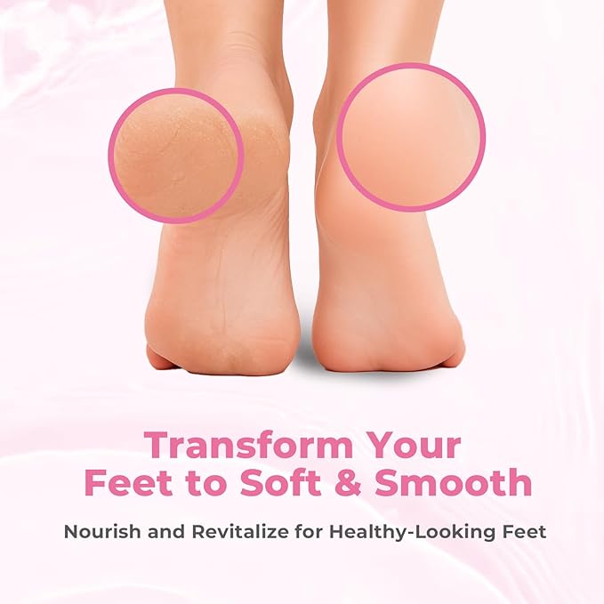 SAISZE Foot Callus Remover with Foot File, Extra Strength Callus Remover Gel with Brush Head, Professional Dead Skin Removal for Feet, 8oz