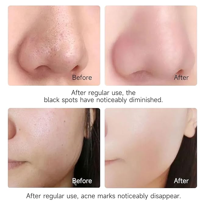 Holy Basil Bubble Deep Cleansing Mask - Purifying & Pore Minimizing Facial Cleaning with Charcoal & Green Tea, Oxygenating Foam for Acne-Prone, Cruelty-Free & Vegan Formula (90g / 3.17 oz) (1 PACK)