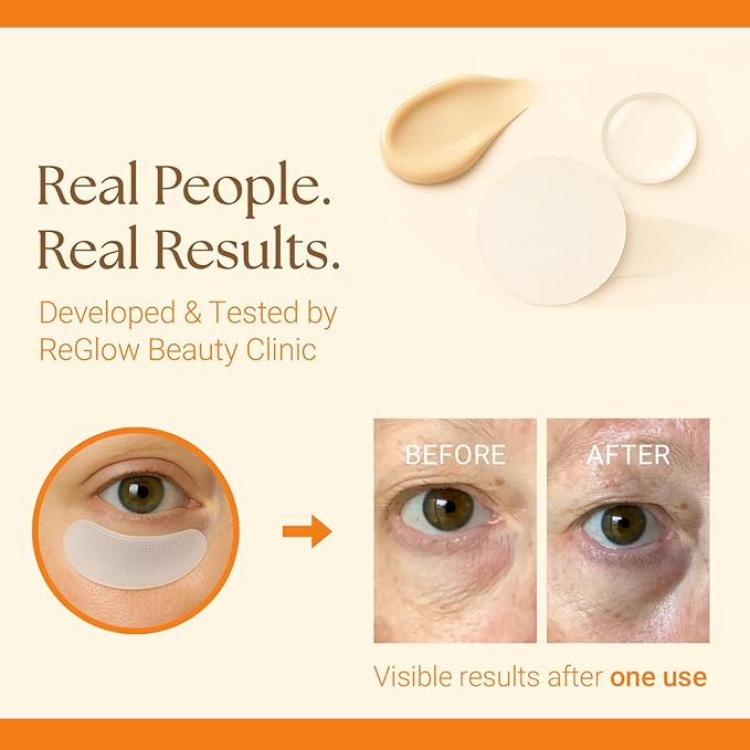 ReGlow Restore Microneedle Eye Patches for Immediate Skin Smoothing – Anti-Aging Under Eye Mask with Hyaluronic Acid, Collagen & Peptides – Helps Reduce Look of Dark Circles Puffiness & Fine Lines