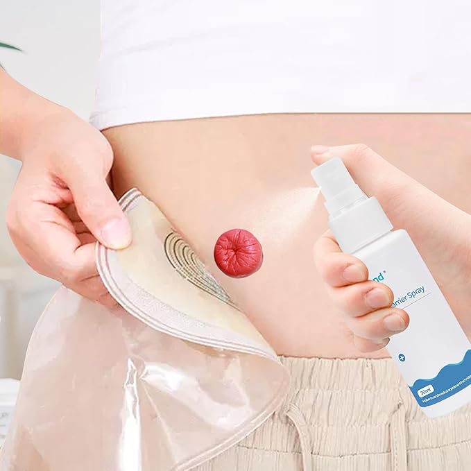 60ml Ostomy Skin Barrier Spray, No-Alcohol No-Sting Ostomy Care Skin Barrier Spray Colostomy Supplies Accessories