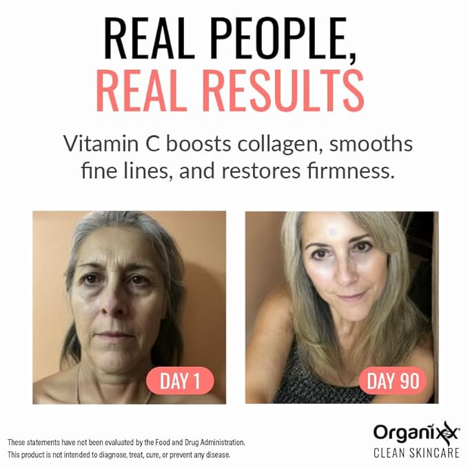 Organixx Restore Vitamin C Serum, Daily Face Serum With Hyaluronic Acid, Organic Vitamin E, Witch Hazel, Glycerin, & Aloe Vera, Brightening Formula, Gentle on Sensitive Skin, Vegan Skin Care, 1 FL Oz