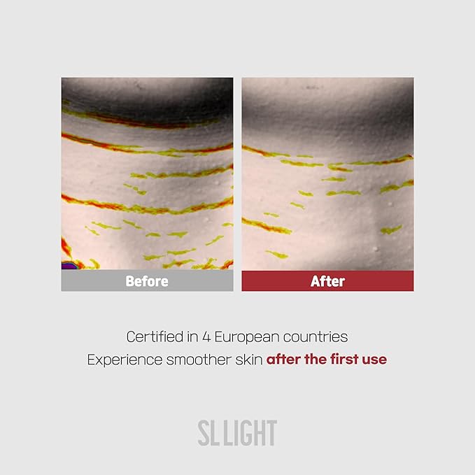 SLLIGHT Retinal Neck Patches (1 Box, 5ea) | Neck Care Mask for Smoothing & Hydrating | With Retinal, Collagen, Elastin & Hyaluronic Acid | Korean Skincare
