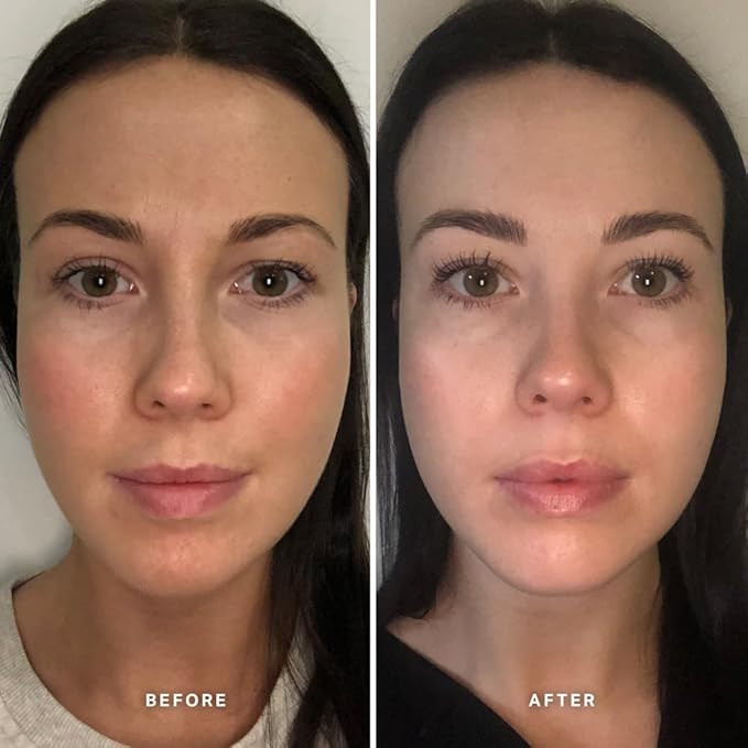 ALPHA-H | Vitamin B Serum with 5% Niacinamide