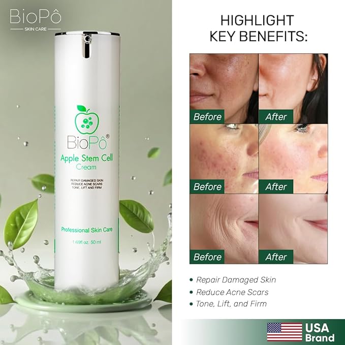 Apple Stem Cell Face Cream Hydrating Moisturizer with Hyaluronic Acid, Softens Skin Texture, Improves Skin Tone & Elasticity – Gentle Daily Cream for All Skin Types, 50 ml