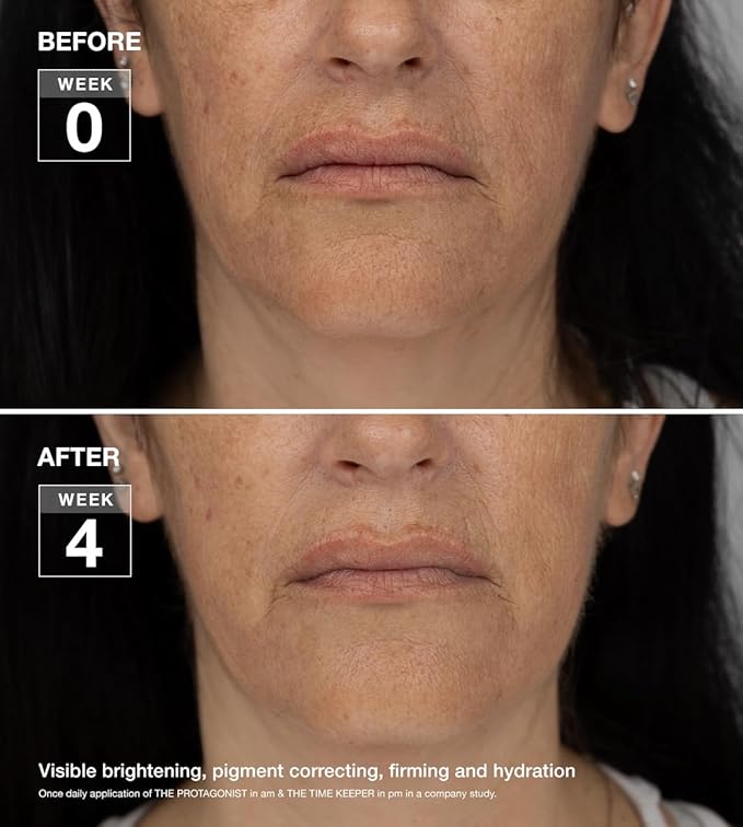 Time Keeper 5-in-1 Peptide Firming Night Cream, 5% Tranexamic Acid, Ceramides for Face, Neck, Eyes, All-In-One Step Serum + Moisturizer
