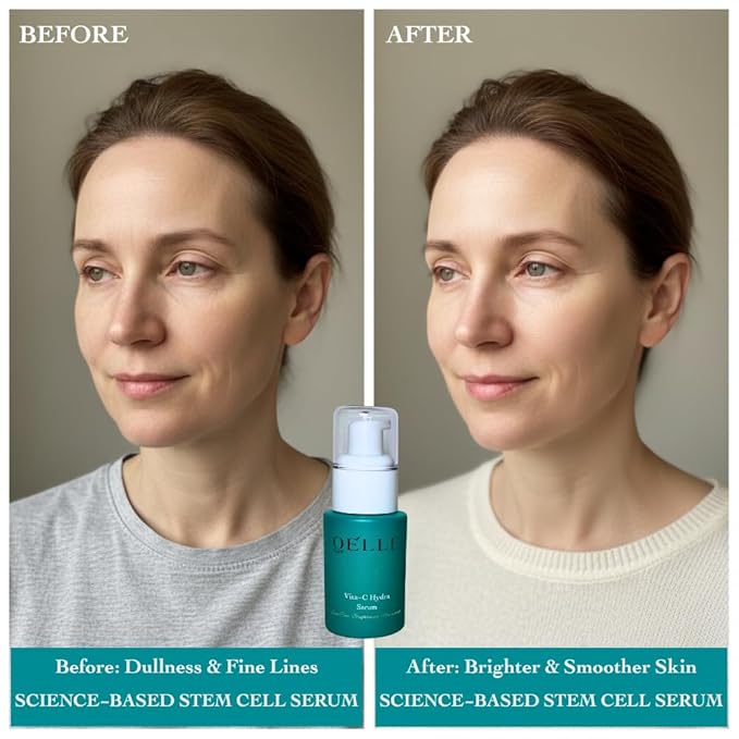 Serum Vitamin C Hydra Glow, with Hyaluronic Acid, Ferulic Acid, MSM & Stem Cells – Brightening, Hydrating, Dark Spot & Fine Line Support, Lightweight Anti-Aging Face Serum