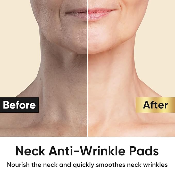 AKQBPN Neck Wrinkle Patches, 24K Gold Collagen Neck Fine Line Pads, Firming Tightening & Moisturizing Mask For Line Romoval