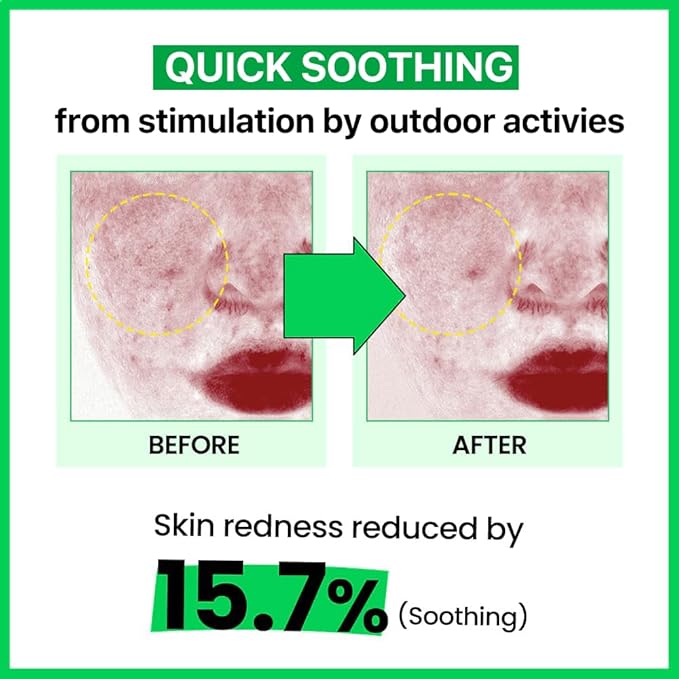 Real Barrier | Cica Relief Rx Fade In Serum | Calming & Skin Recovery Face Serum | Instant Relief from Skin Irritation | Soothing Moisturizer for Sensitive Skin | Korean Skin Care | 1.69 fl oz (50ml)
