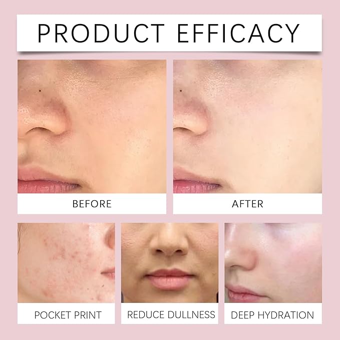 Nicotinamide Facial Spray with Rose, Aloe Extract & Vitamin E, Deep Hydration, Smooth and Hydrated Skin for All Skin Types, 3.38 fl oz