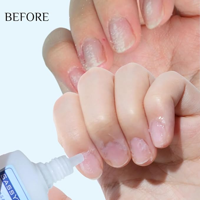 SASSYTIP Cuticle Remover Gel - Cuticle Removal & Deep Hydration, Ideal for Prepping Press-Ons, Gel Nails & Dry Cuticles, Trusted by Manicurists & Nail Artists, 1 fl oz Cucumber Fresh (Clear)