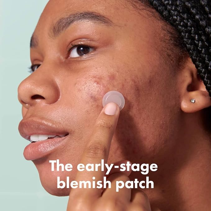 Mighty Patch Micropoint Large Hydrocolloid Pimple Patches for Face Blemishes from Hero Cosmetics, Acne Stickers for Early Stage Zits & Hidden Pimples, 395 Proprietary Micropoints, 8 Count