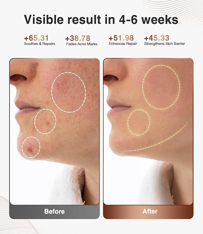 JOVS 4D Red Light Therapy Mask for Face with 4 Color Light Modes, Breathable Wireless 328 LEDs Face Mask with 850NM Near-Infrared Light, Portable LED Face Mask Light Therapy with Timer for Home Travel