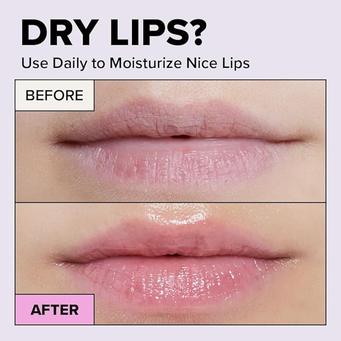 I DEW CARE Overnight Lip Sleeping Mask - Plush Party | Buttery Vitamin C, Lip Glaze, Moisturizing Balm, With Cocoa Butter For Dry Lips, Glass Skin Look, Nourish and Hydrate, Korean Skin, 0.42 Oz