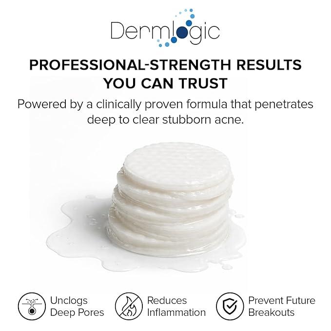 Acne Treatment Pads- Contains Salicylic, Glycolic, & Lactic Acid for Face & Body. Clears Away Clogged Pores, Oily Skin & Cystic Breakouts. Removes Dark Spots, Blackhead & Whitehead Pimples