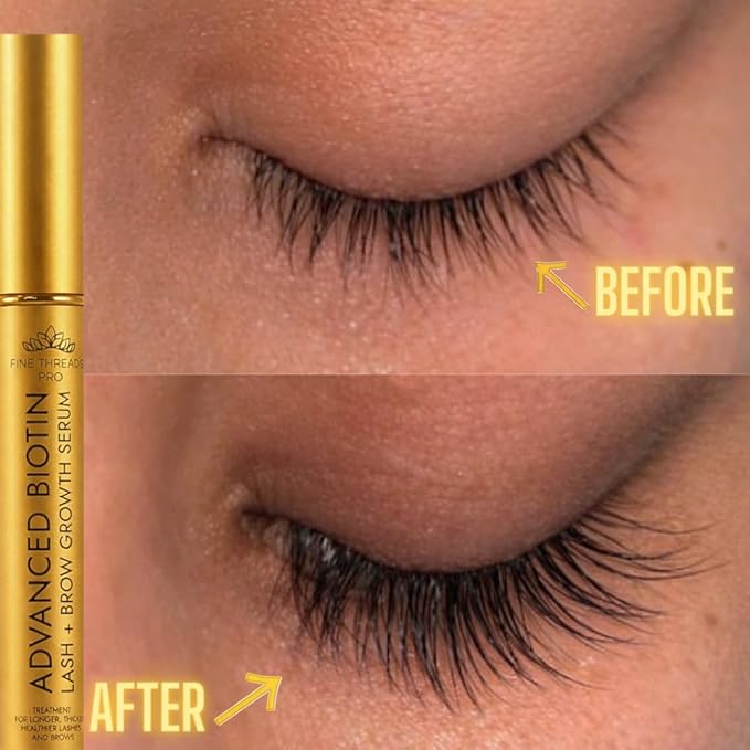 Lash Serum for Eyelash Growth – Advanced Formula Eyelash Growth Serum for Longer, Fuller, Thicker Lashes & Eyebrows – Premium Gentle Vegan Formula for Sensitive Eyes