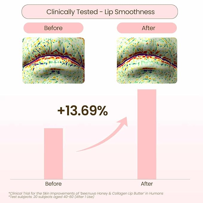 beenuvo Honey & Collagen Lip Butter, Hydrating Lip Treatment, Overnight Lip Mask, Moisturizing Lip Balm with Jojoba Oil & Squalane, Lip Care, Korean Skin Care (0.45 oz)