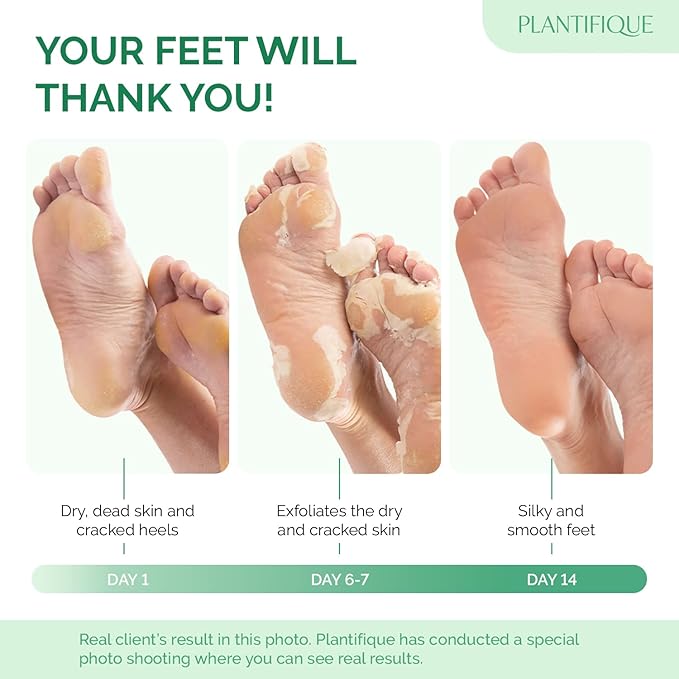 PLANTIFIQUE Foot Peeling Mask 2 Pack | Dermatologically Tested Repairs Heels & Removes Dry Dead Skin for Baby Soft Feet | Exfoliating Foot Peel Mask for Dry Cracked Feet | Peach