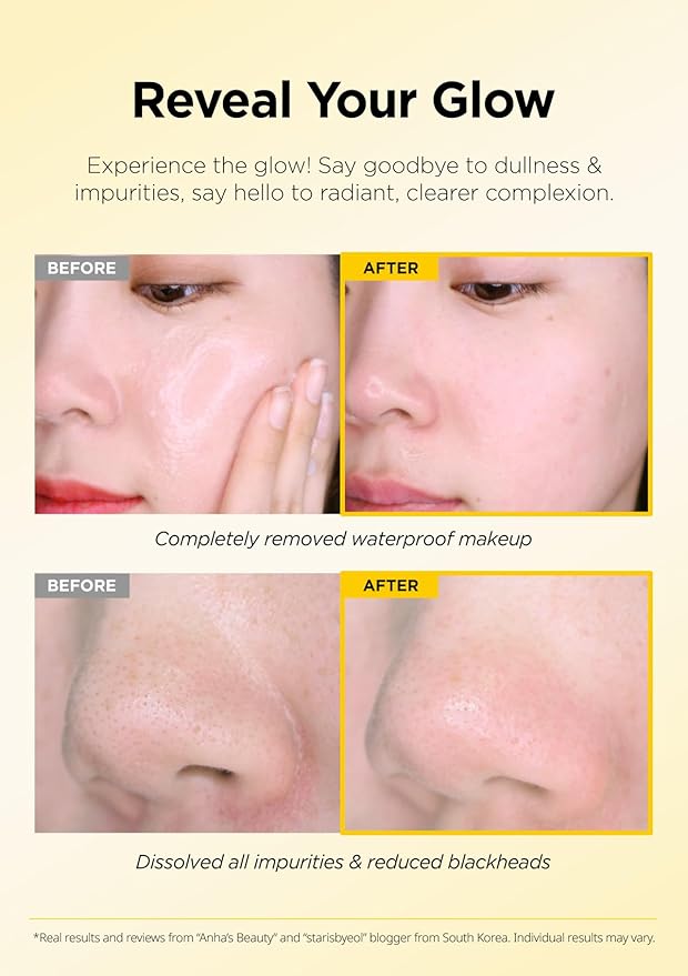 Hanskin PHA Pore Cleansing Balm – Korean Melting Balm Cleanser for Blackheads | Gentle Makeup Remover for Sensitive Skin | Solid-to-Oil Cleanser with PHA & Nourishing Oils | K-Beauty | 2.82 oz