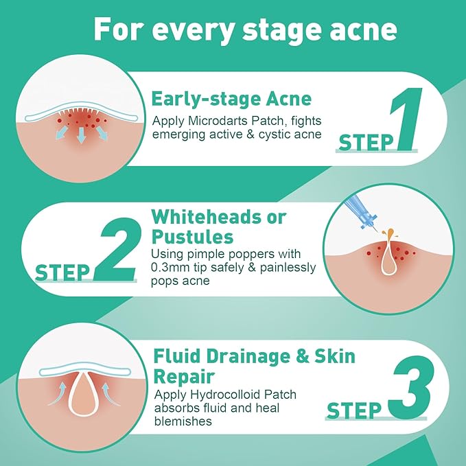 TEAWOO 3-Step Microdart Pimple Patches Set – 83 Count, including 9 Microdarts Pimple Patches, 50 Pimple Poppers, and 24 Hydrocolloid Patches